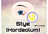 Stye.pdf